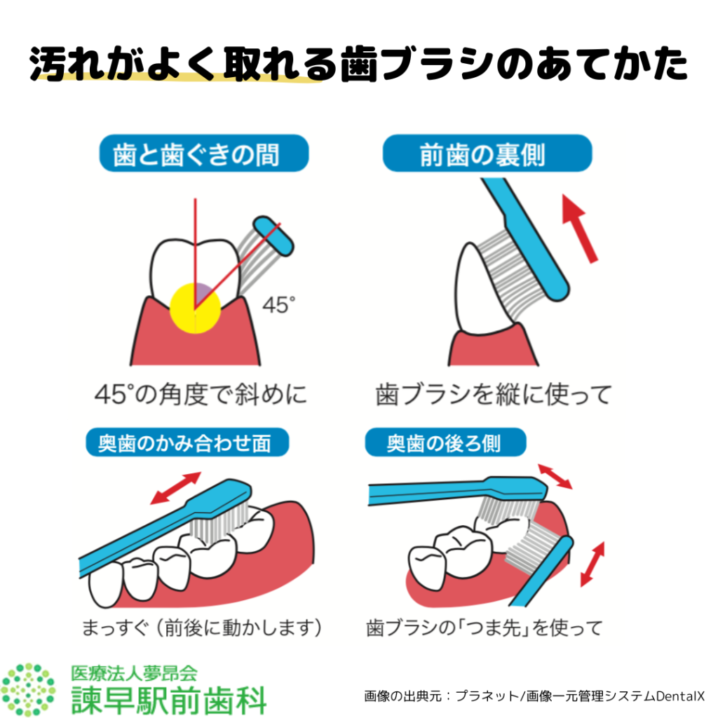 諫早　歯医者　歯磨き指導