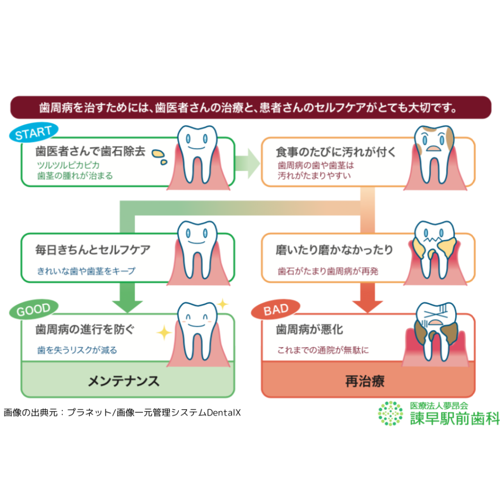 長崎　諫早　歯石　歯周病治療