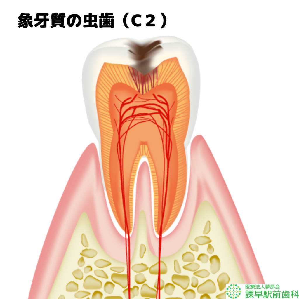 長崎　諫早　歯医者　諫早駅前　歯の構造