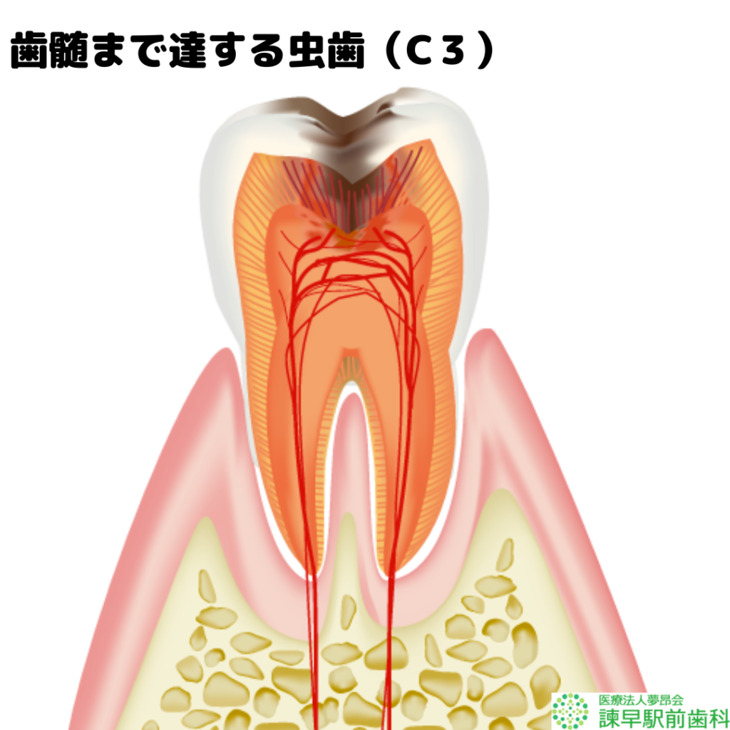 長崎　諫早　歯医者　諫早駅前　歯の構造