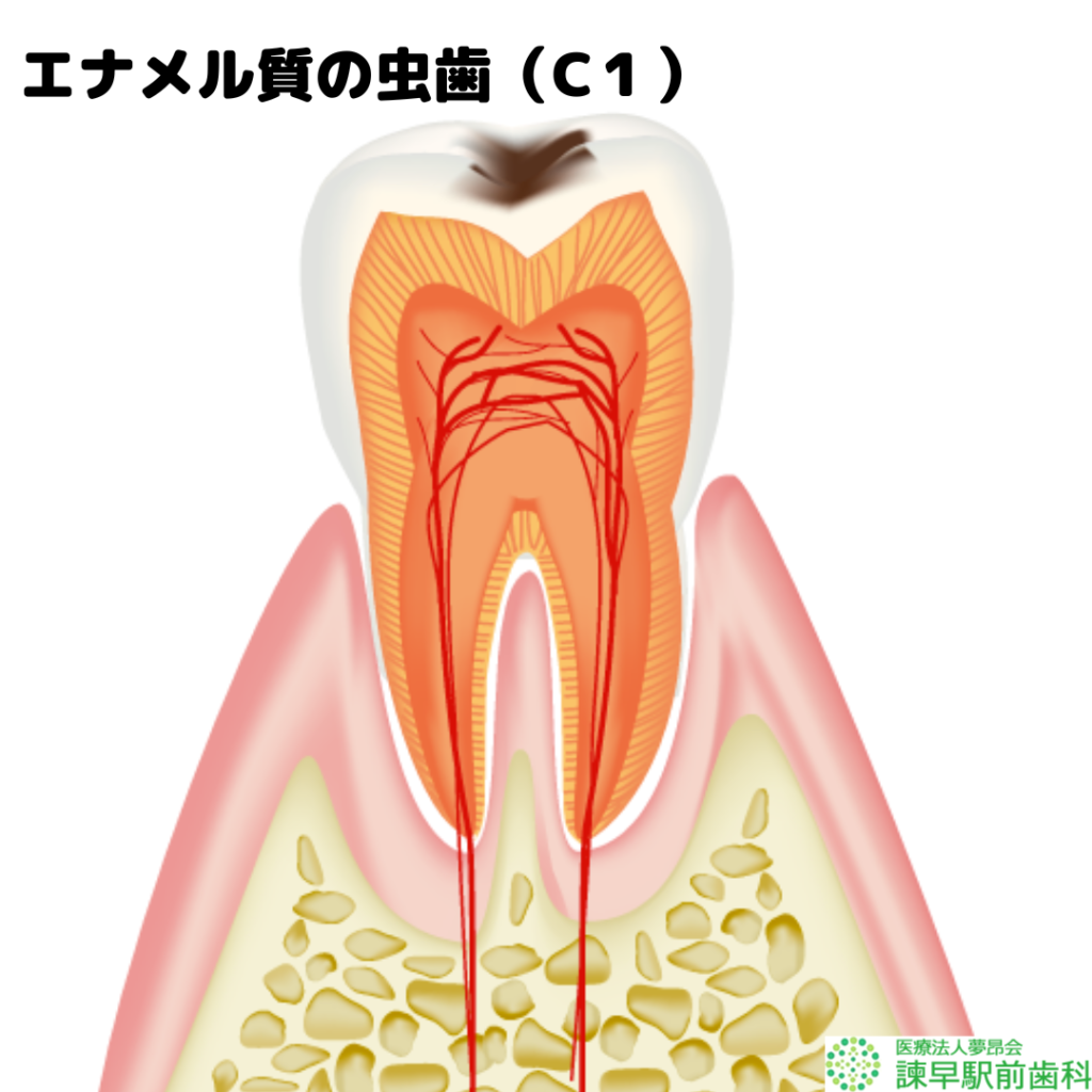 長崎　諫早　歯医者　諫早駅前　歯の構造