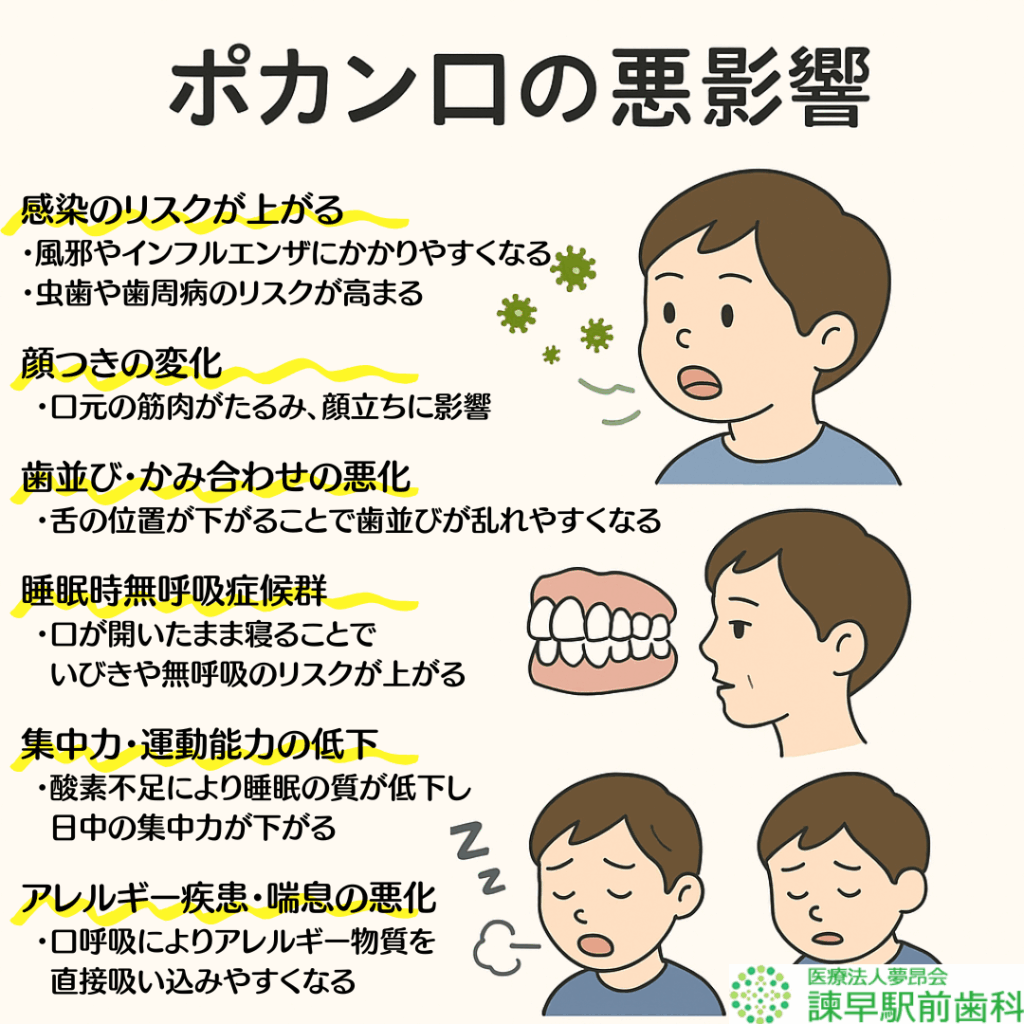 諫早 歯医者 お口ポカン