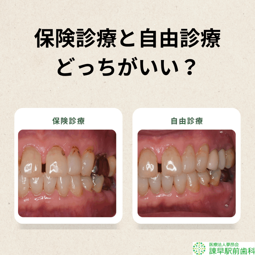 諫早 虫歯治療 歯医者