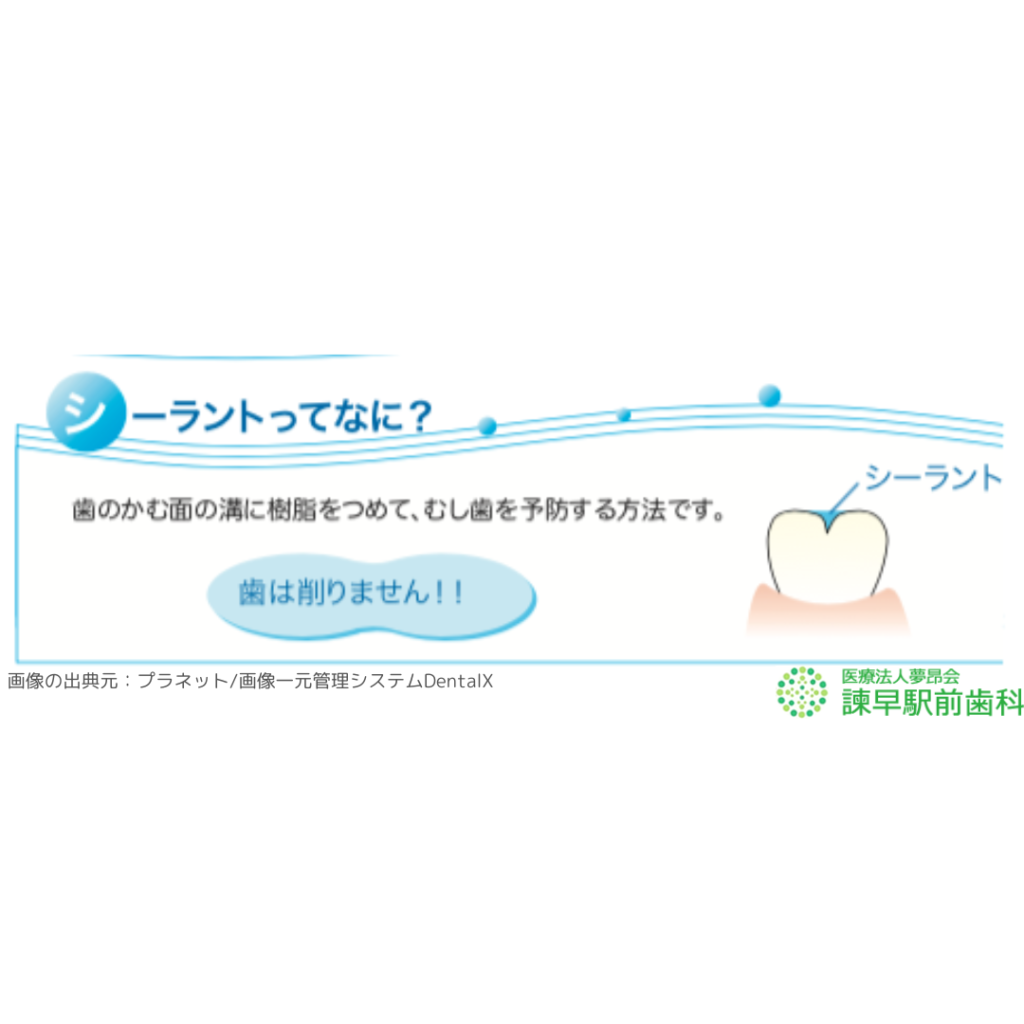 シーラントの説明